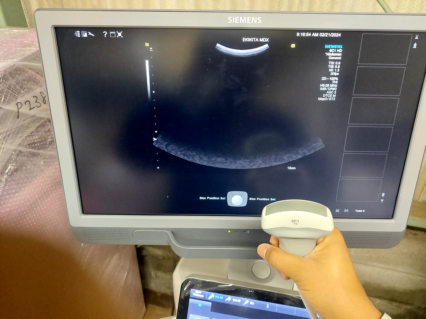 ACUSON S2000 ABVS Ultrasound System, YOM: 2019 HELX Evolution with Touch Control