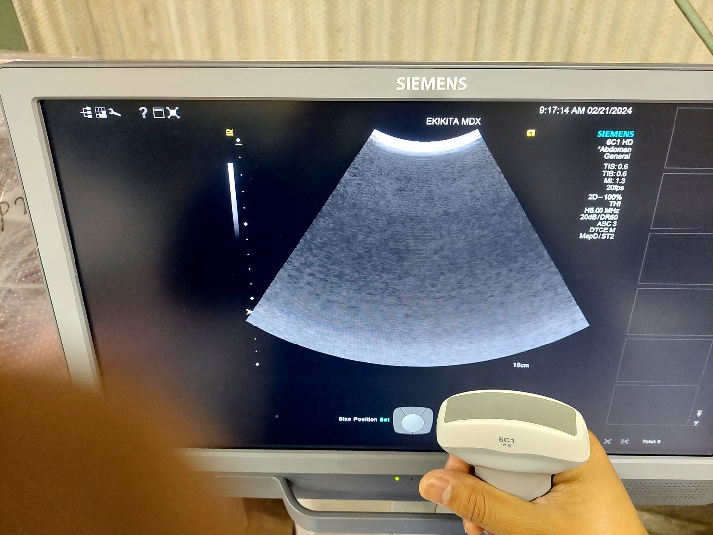 ACUSON S2000 ABVS Ultrasound System, YOM: 2019 HELX Evolution with Touch Control