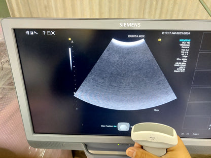 ACUSON S2000 ABVS Ultrasound System, YOM: 2019 HELX Evolution with Touch Control