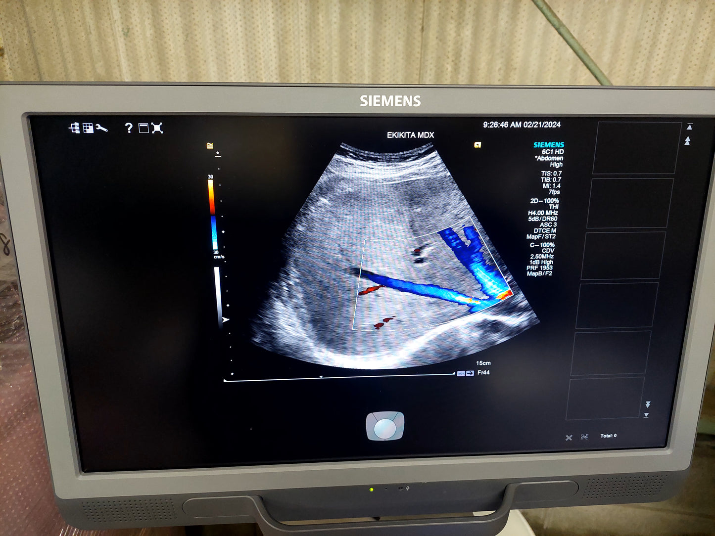 ACUSON S2000 ABVS Ultrasound System, YOM: 2019 HELX Evolution with Touch Control