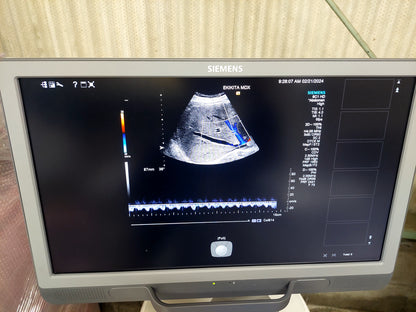 ACUSON S2000 ABVS Ultrasound System, YOM: 2019 HELX Evolution with Touch Control