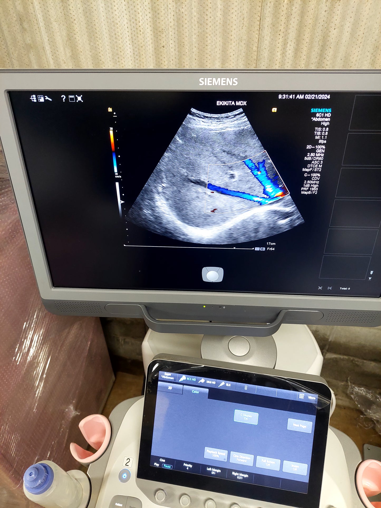 ACUSON S2000 ABVS Ultrasound System, YOM: 2019 HELX Evolution with Touch Control