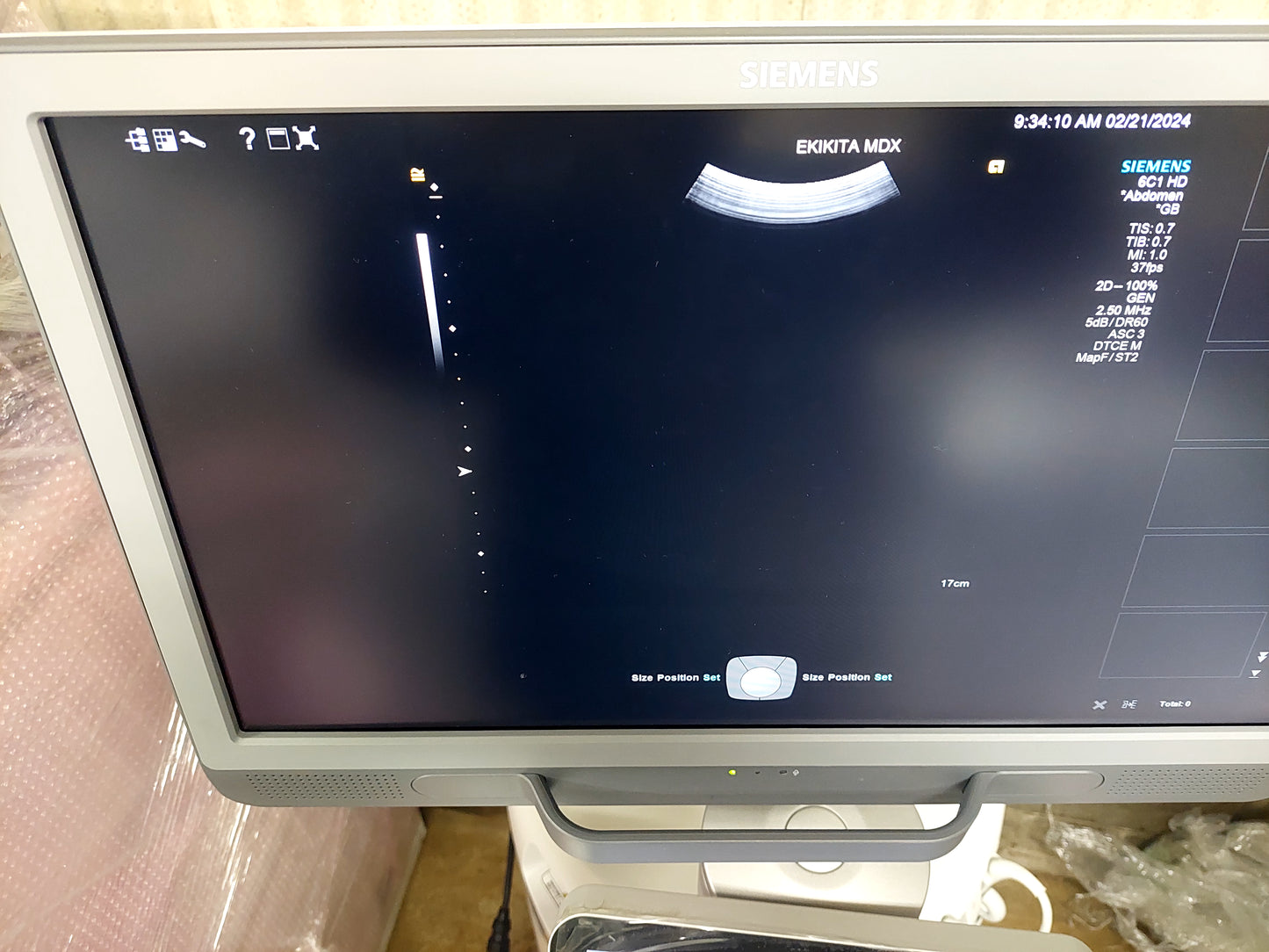 ACUSON S2000 ABVS Ultrasound System, YOM: 2019 HELX Evolution with Touch Control