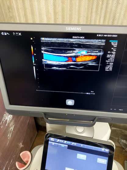 ACUSON S2000 ABVS Ultrasound System, YOM: 2019 HELX Evolution with Touch Control