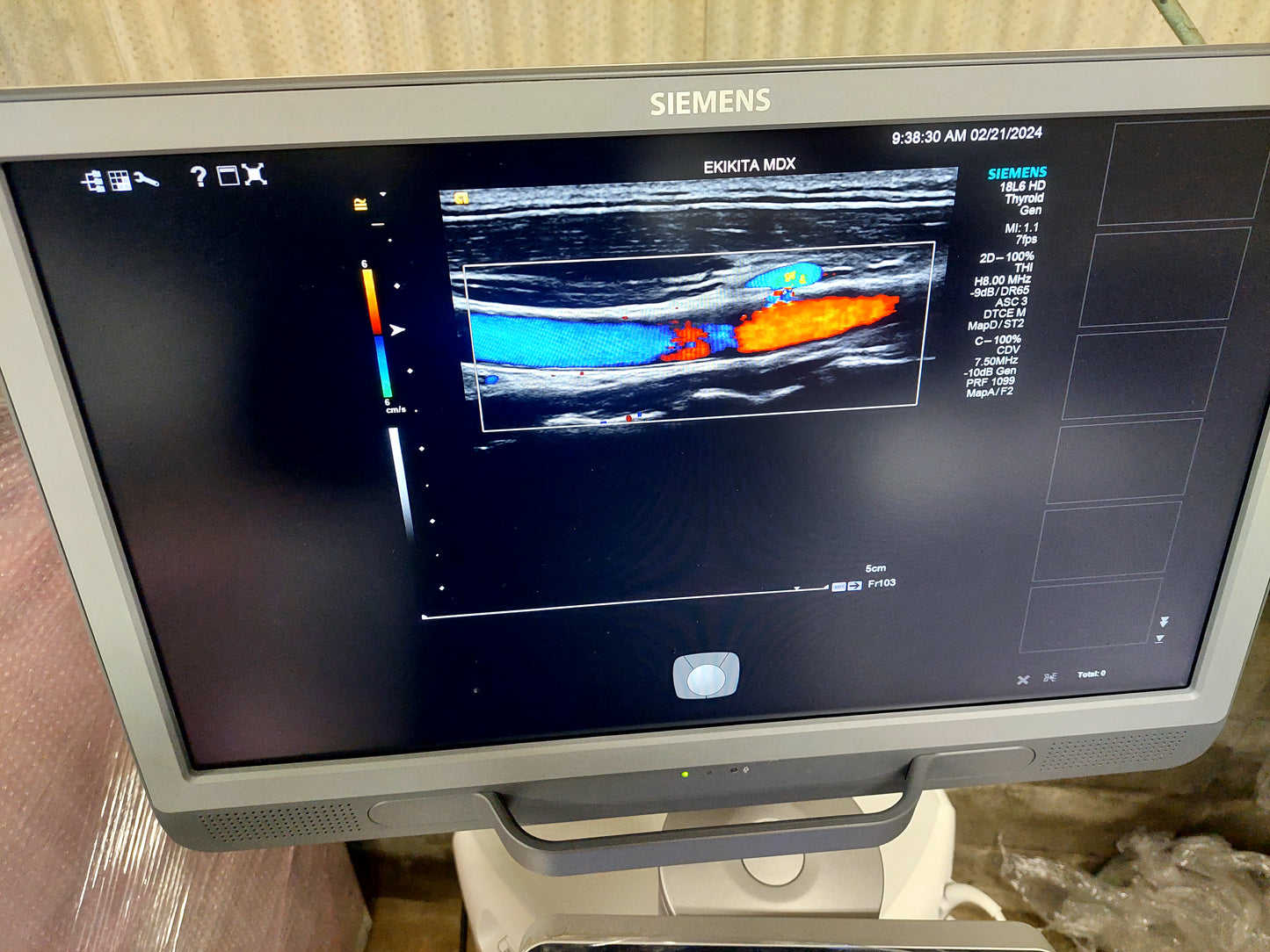 ACUSON S2000 ABVS Ultrasound System, YOM: 2019 HELX Evolution with Touch Control