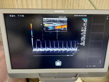 ACUSON S2000 ABVS Ultrasound System, YOM: 2019 HELX Evolution with Touch Control