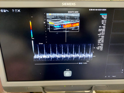 ACUSON S2000 ABVS Ultrasound System, YOM: 2019 HELX Evolution with Touch Control