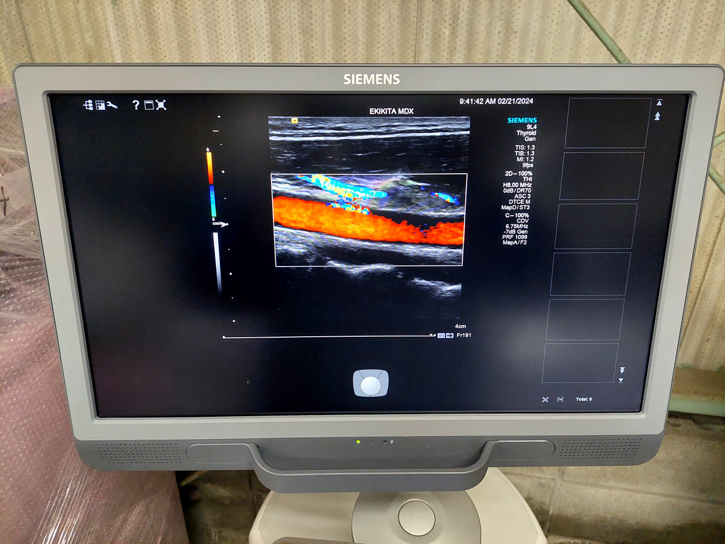 ACUSON S2000 ABVS Ultrasound System, YOM: 2019 HELX Evolution with Touch Control