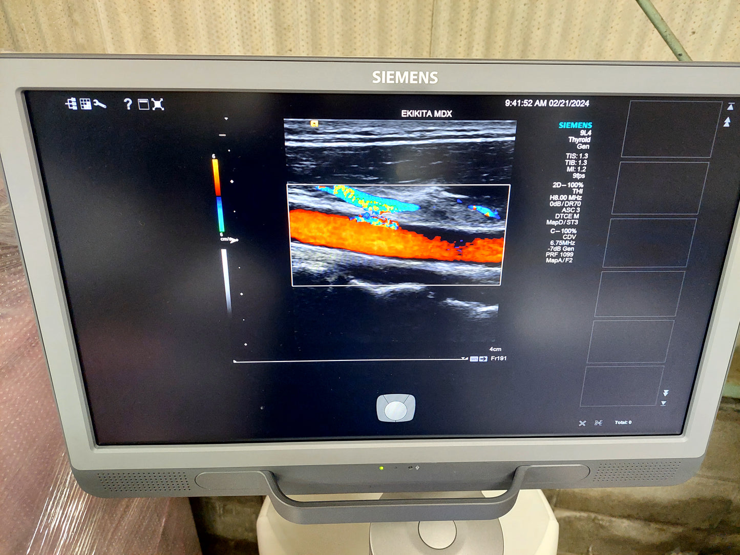 ACUSON S2000 ABVS Ultrasound System, YOM: 2019 HELX Evolution with Touch Control