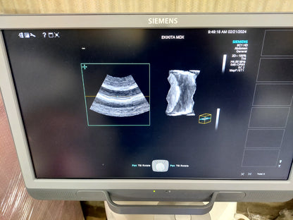 ACUSON S2000 ABVS Ultrasound System, YOM: 2019 HELX Evolution with Touch Control