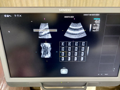 ACUSON S2000 ABVS Ultrasound System, YOM: 2019 HELX Evolution with Touch Control