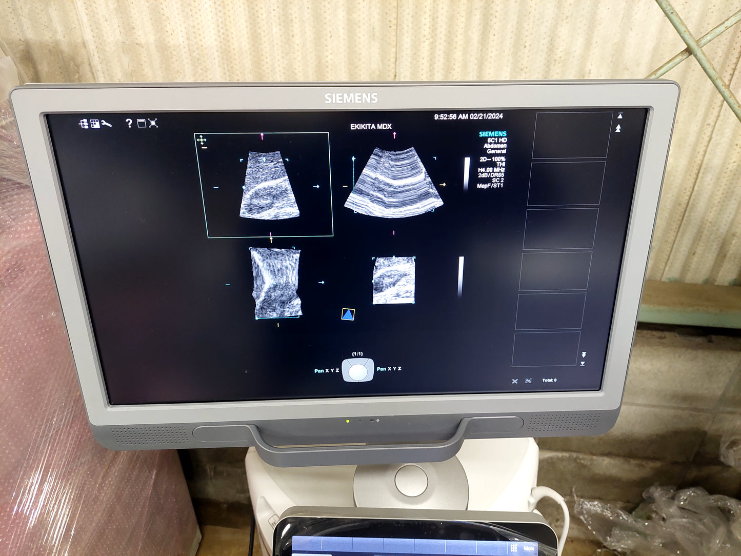 ACUSON S2000 ABVS Ultrasound System, YOM: 2019 HELX Evolution with Touch Control