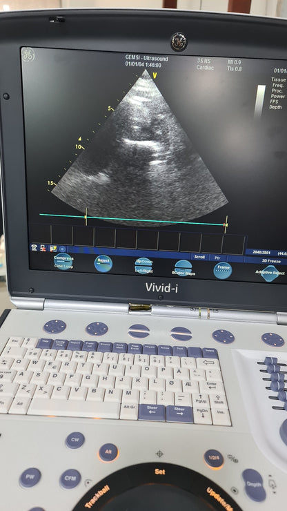 3S-RS Probed Checked Av (B)