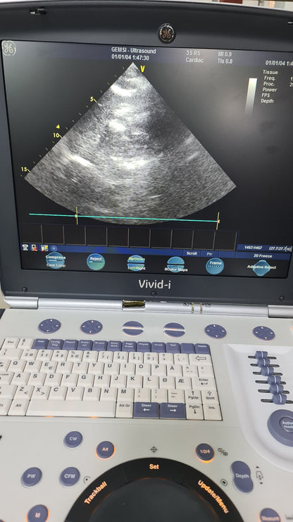 3S-RS Probed Checked Av (B)