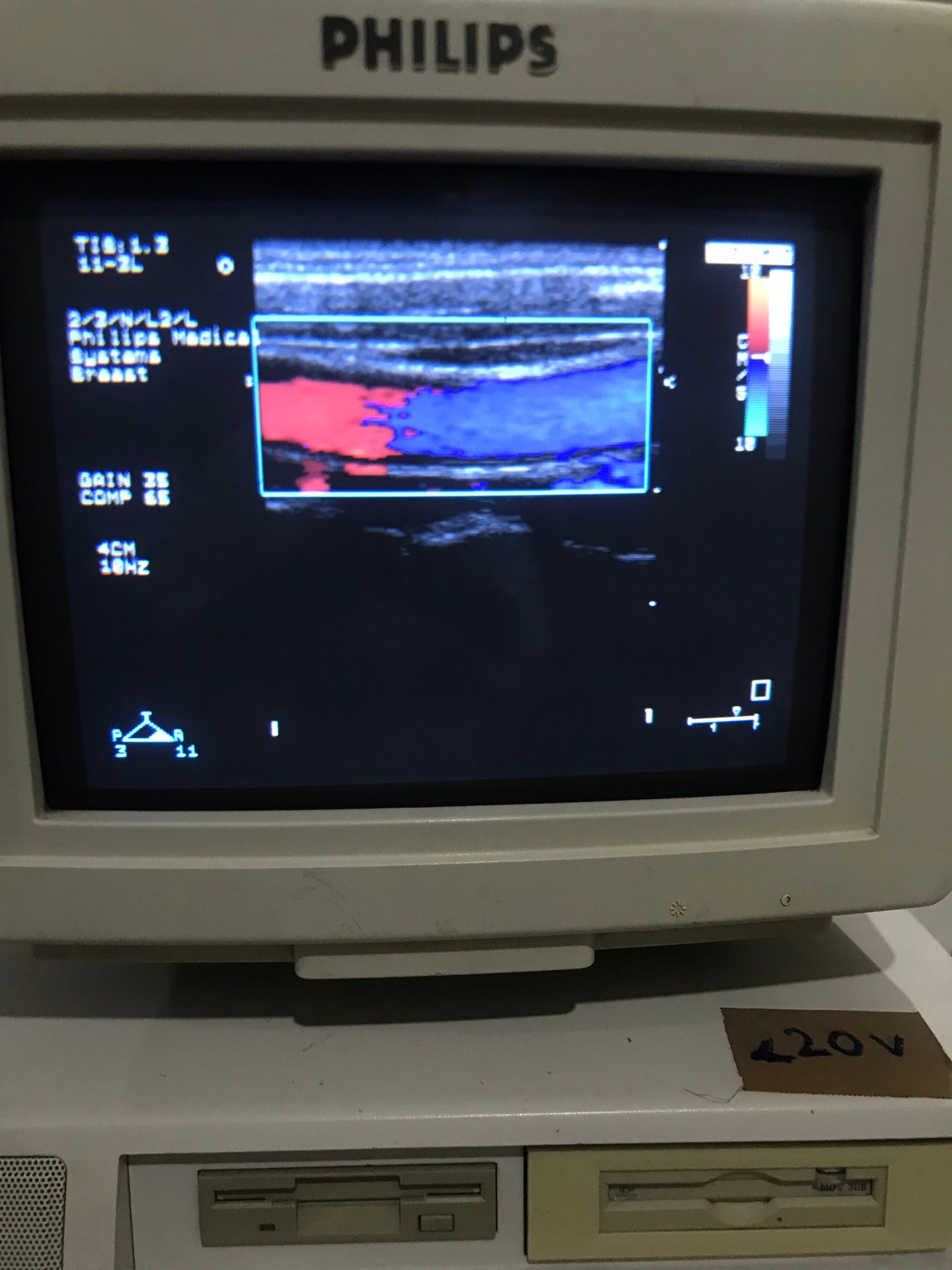 P...Philips 11-3L Linear Probe checked dxb