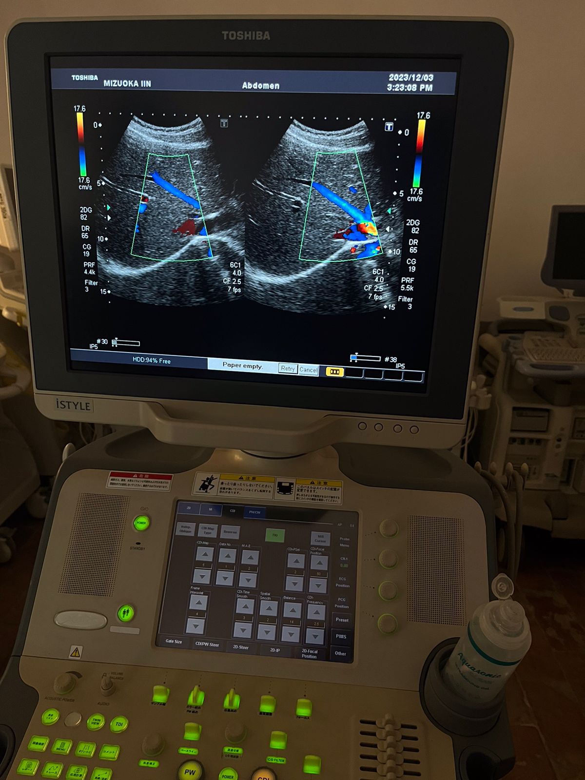 Toshiba Xario Prime with 2 probes, convex+linear