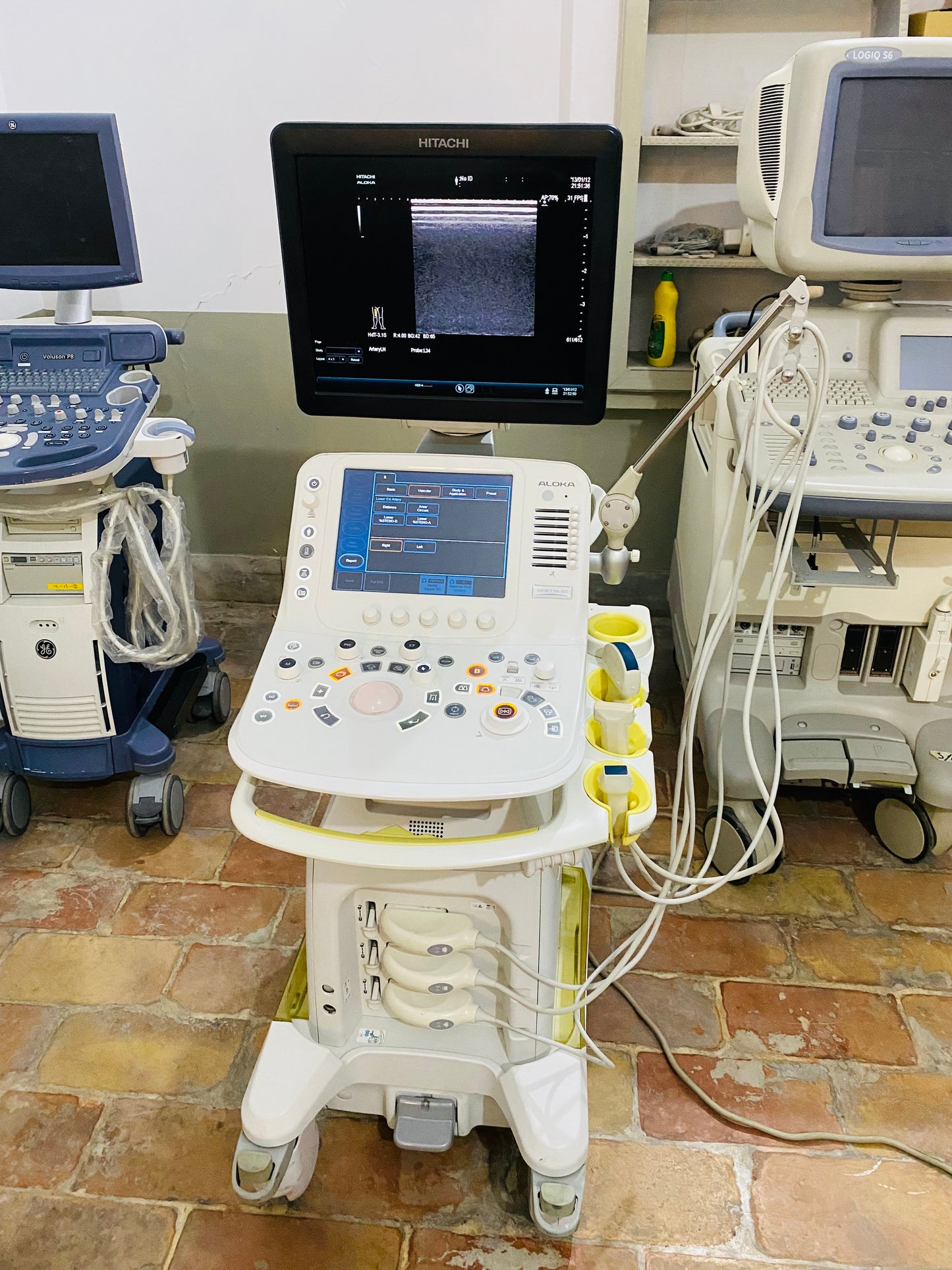 Hitachi Aloka ARIETTA 60 with convex linear cardiac probe, convex probe has air shade. Also can sell it's probes and parts separately