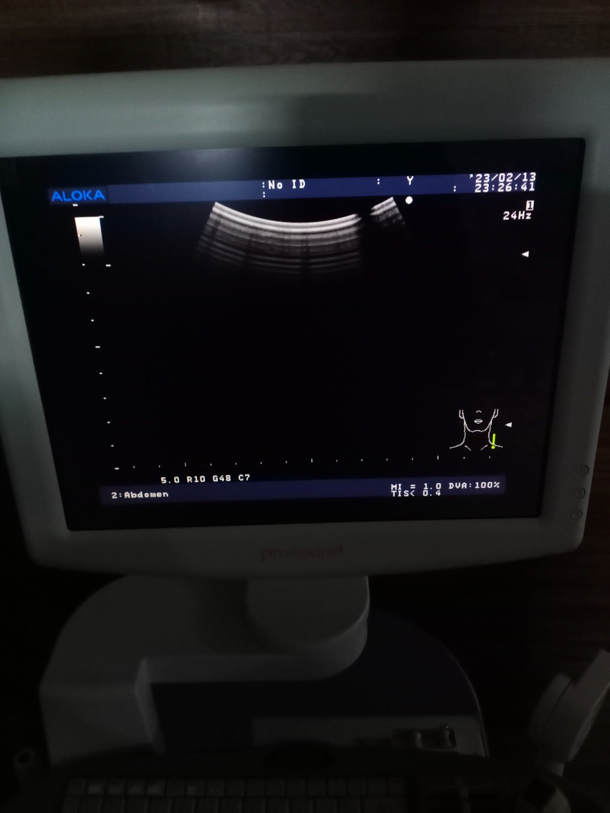 ..Hitachi UST-9123 convex probe - Japan Medical Company LTD