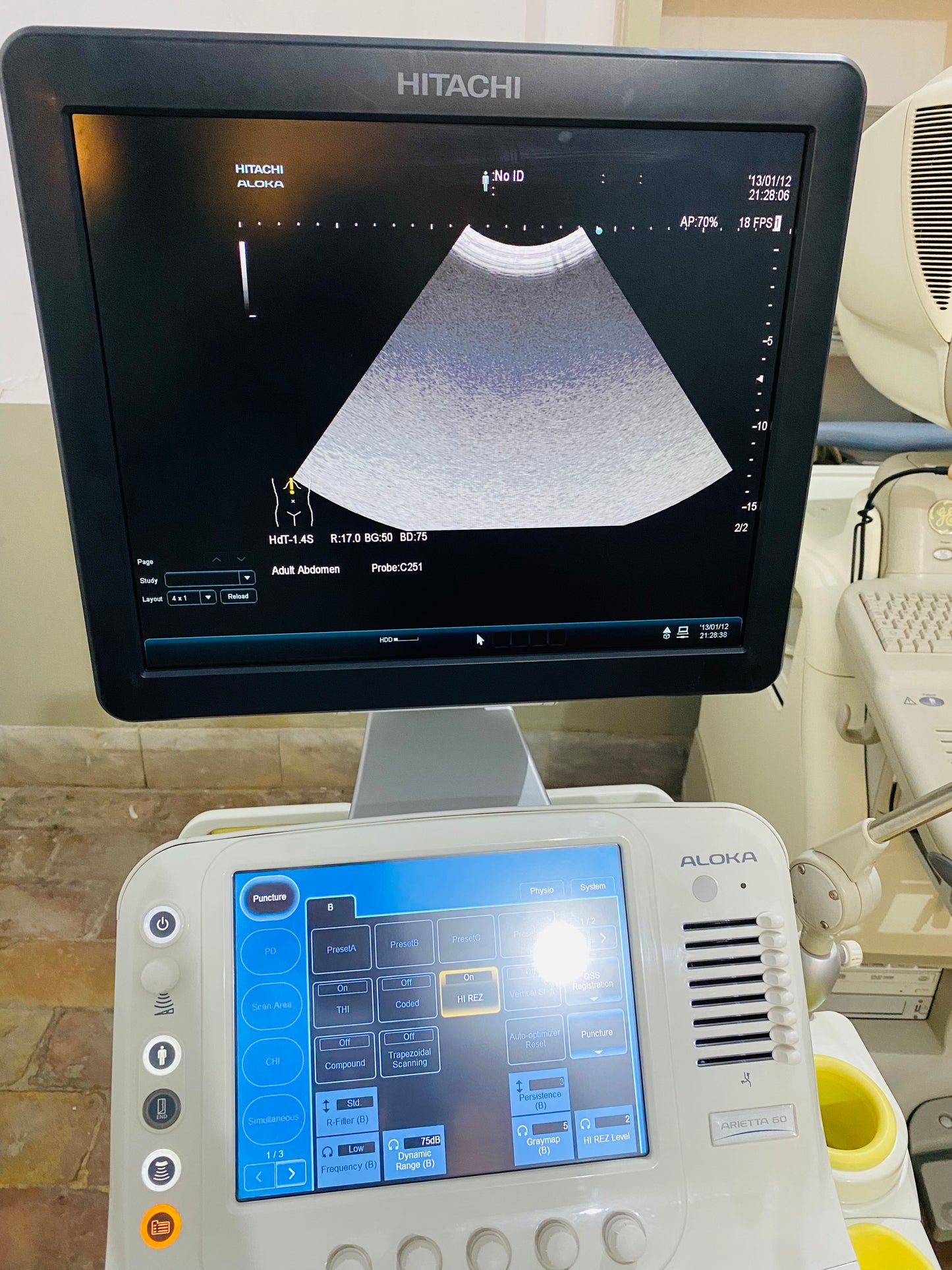 Hitachi Aloka ARIETTA 60 with convex linear cardiac probe, convex probe has air shade. Also can sell it's probes and parts separately