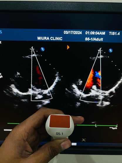 ..Philips S5-1 cardiac probe