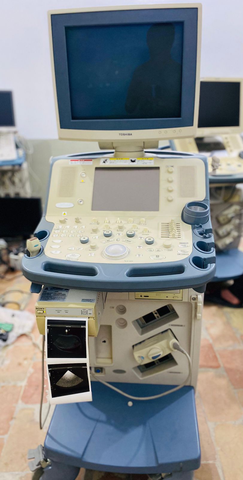 Toshiba Xario prime CRT with adult cardiac probe