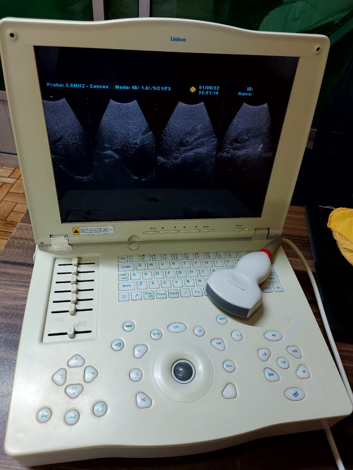 B..Linkton gray scale ultrasound machine, china used with convex probe