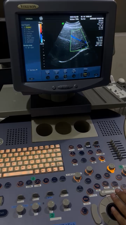 GE Voluson 730 pro v with convex probe