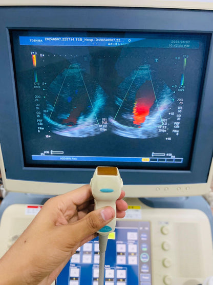 Toshiba Xario prime CRT with adult cardiac probe