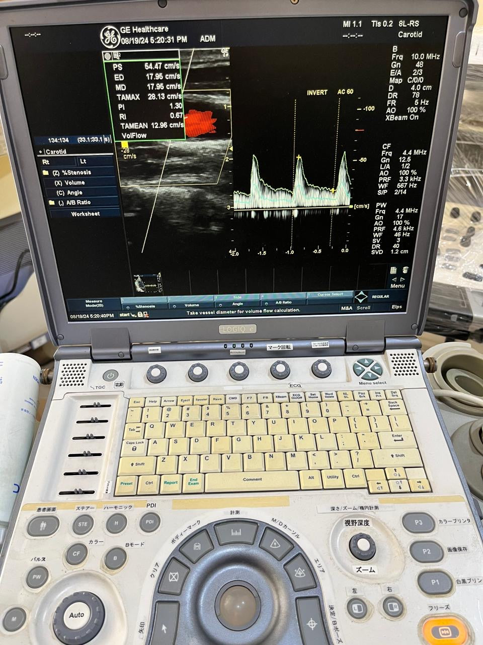 ..GE 8L-RS linear probe