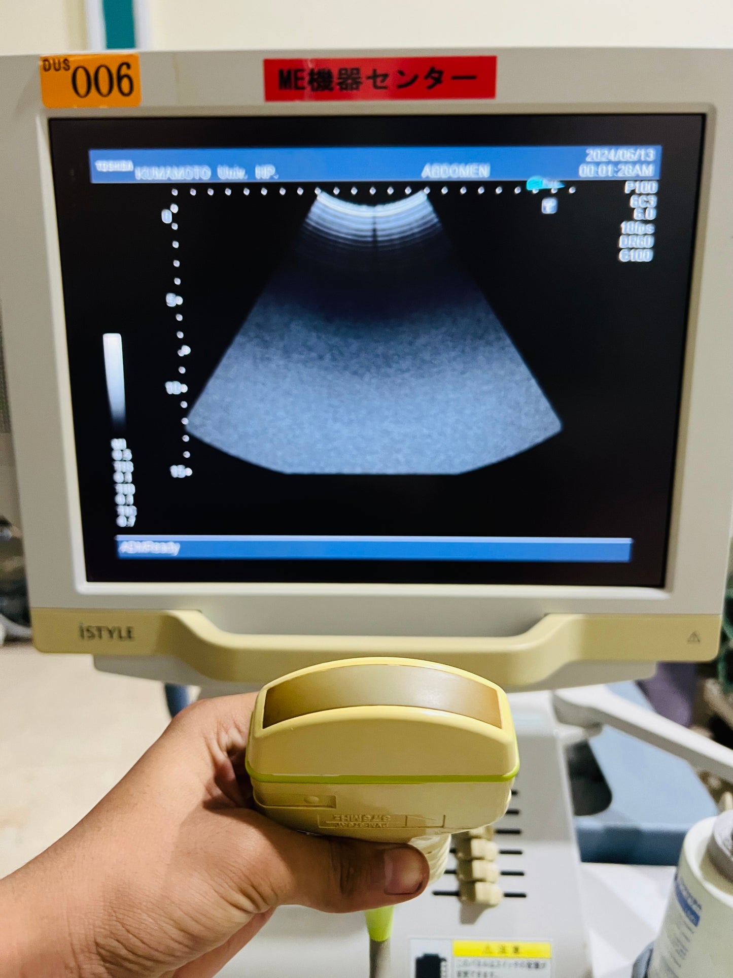 ..Toshiba PVM-375AT convex probe