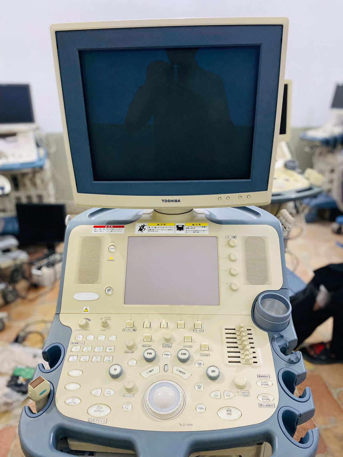 Toshiba Xario prime CRT with adult cardiac probe