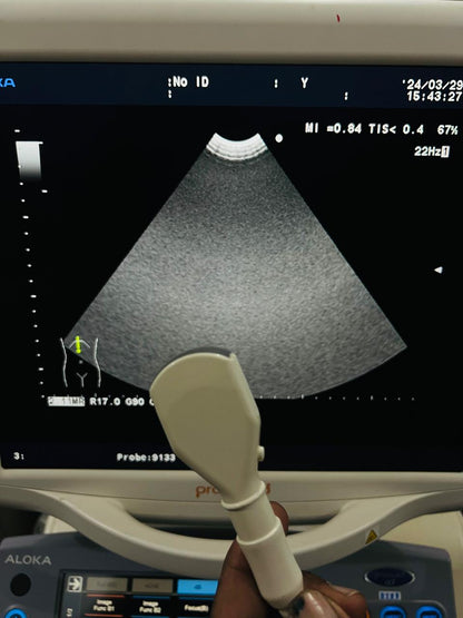 ..Aloka UST-9133 micro convex probe - Japan Medical Company LTD