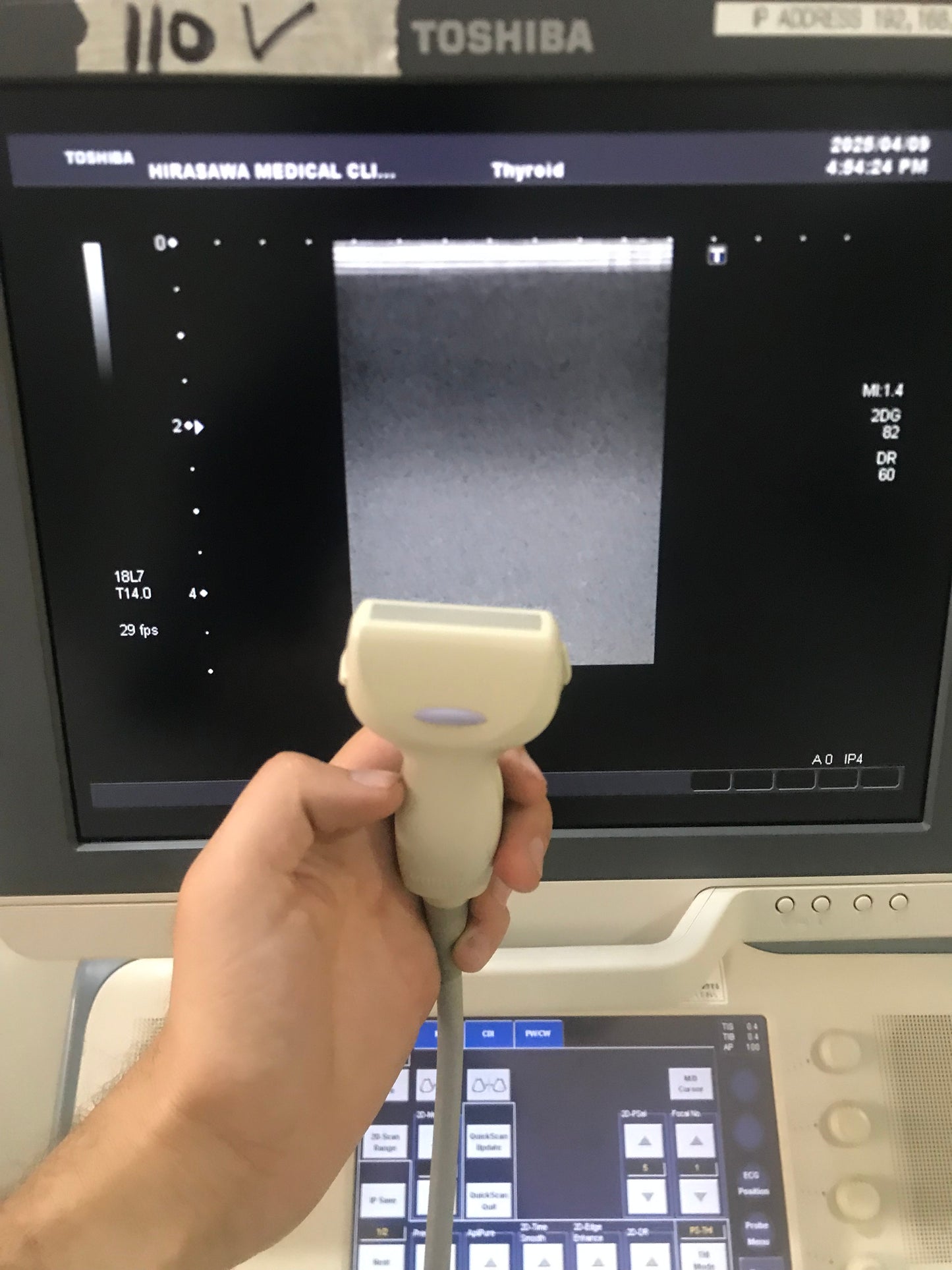 PLT-1204BT linear probe
