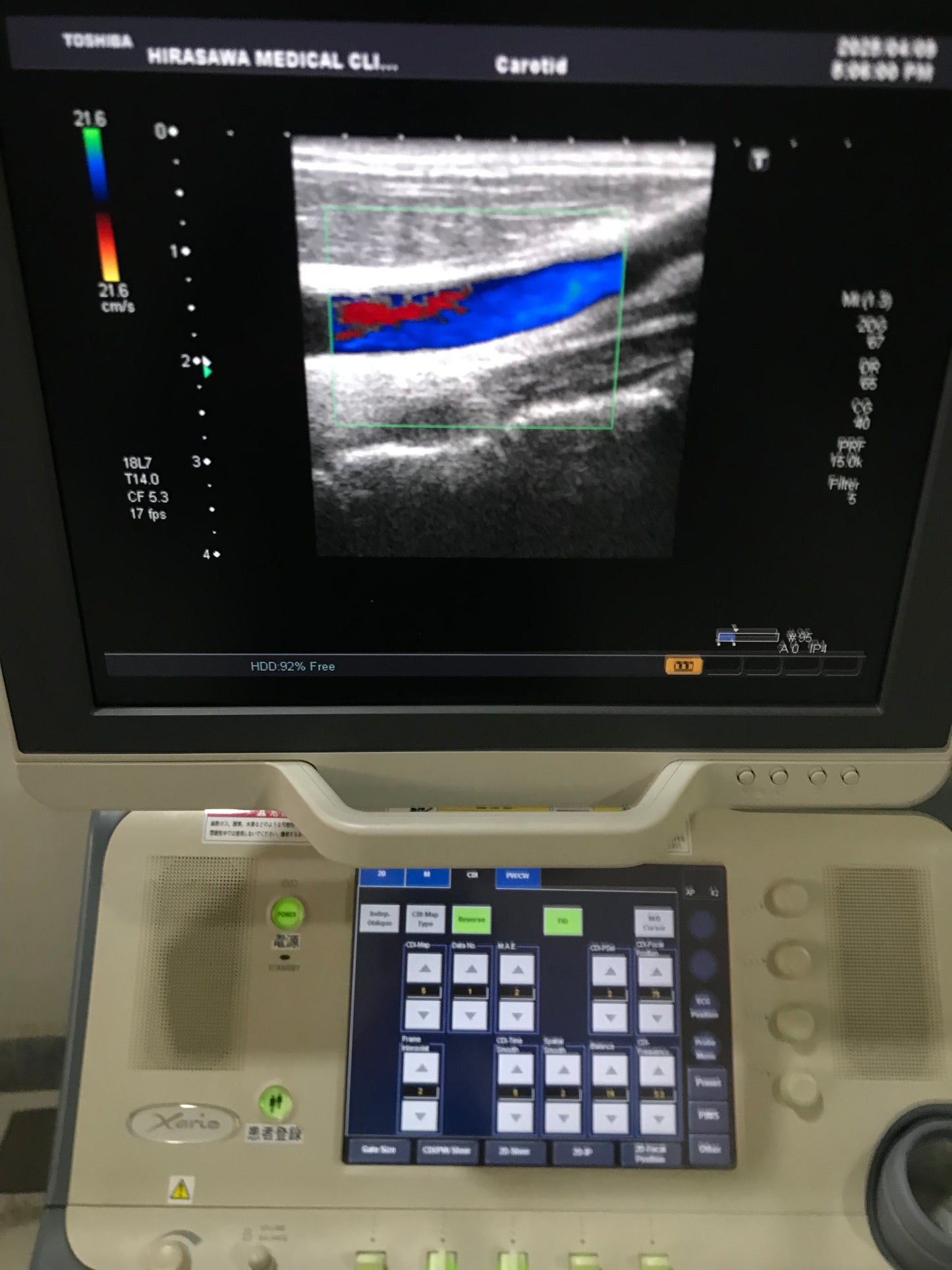 PLT-1204BT linear probe