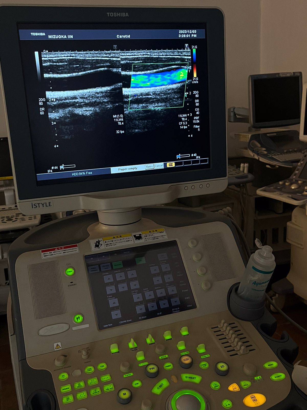 Toshiba Xario Prime with 2 probes, convex+linear