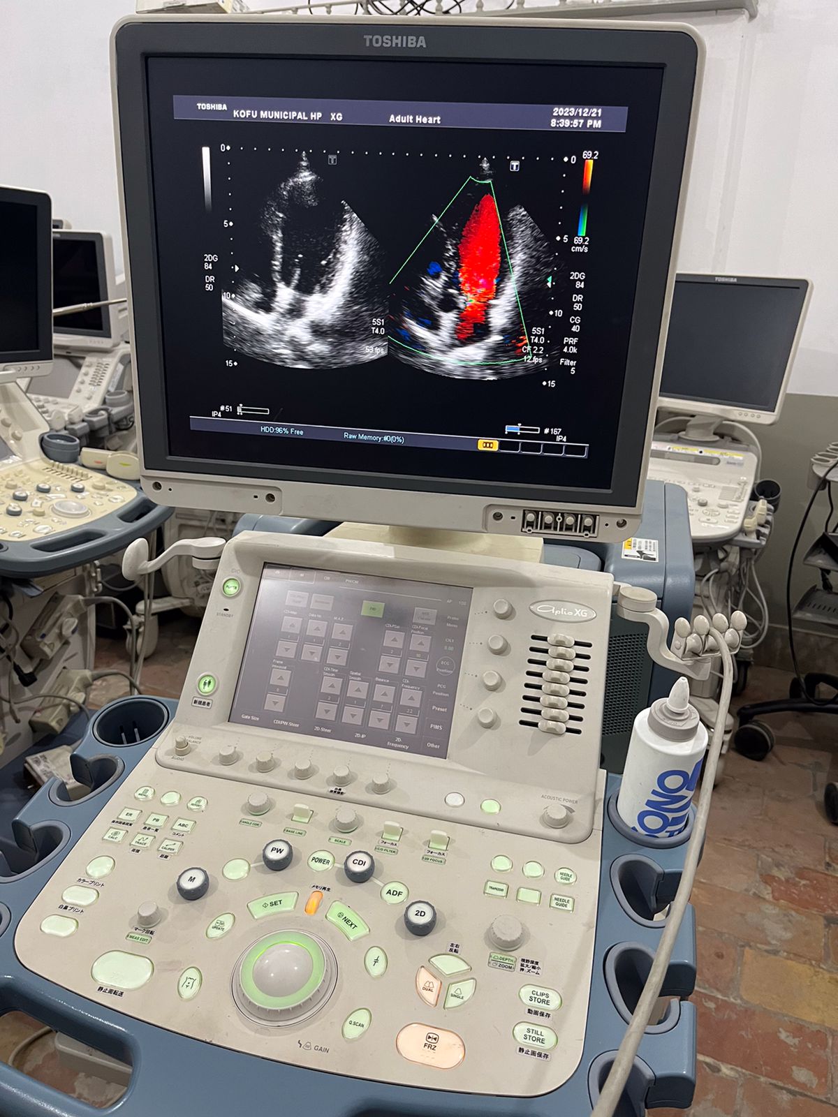 Toshiba Aplio XG Ultrasound machine with adult cardiac probe