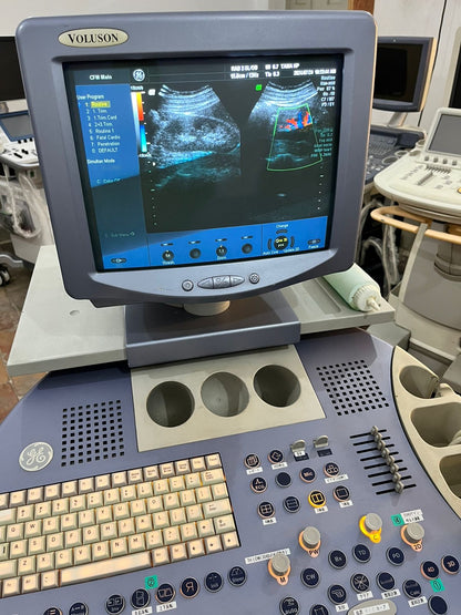 GE Voluson 730 Pro V with 3D/4D probe