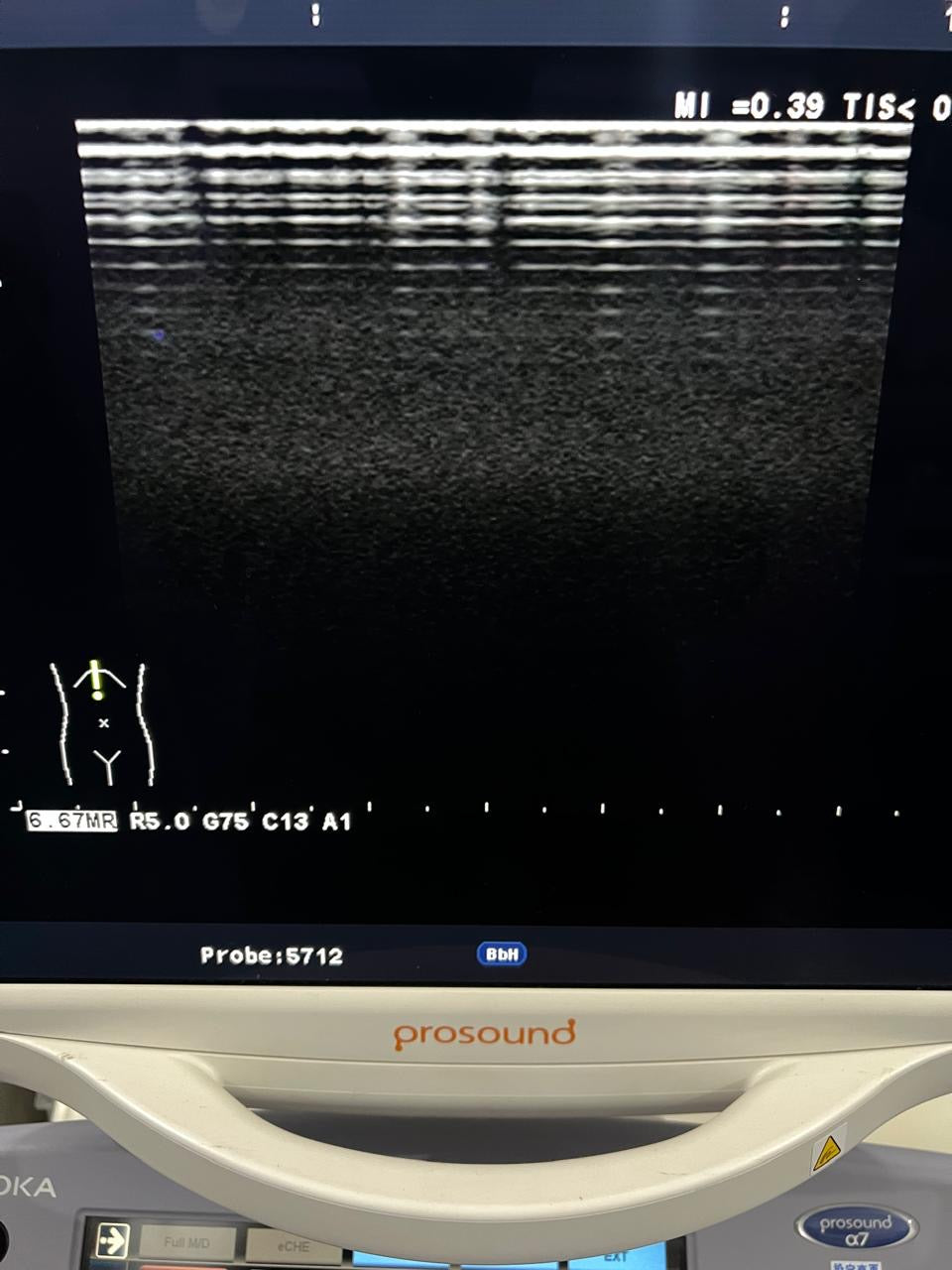 ..Hitachi UST-5712 linear vascular probe - Japan Medical Company LTD