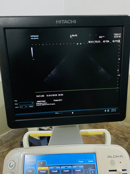 Hitachi Aloka ARIETTA 60 with convex linear cardiac probe, convex probe has air shade. Also can sell it's probes and parts separately