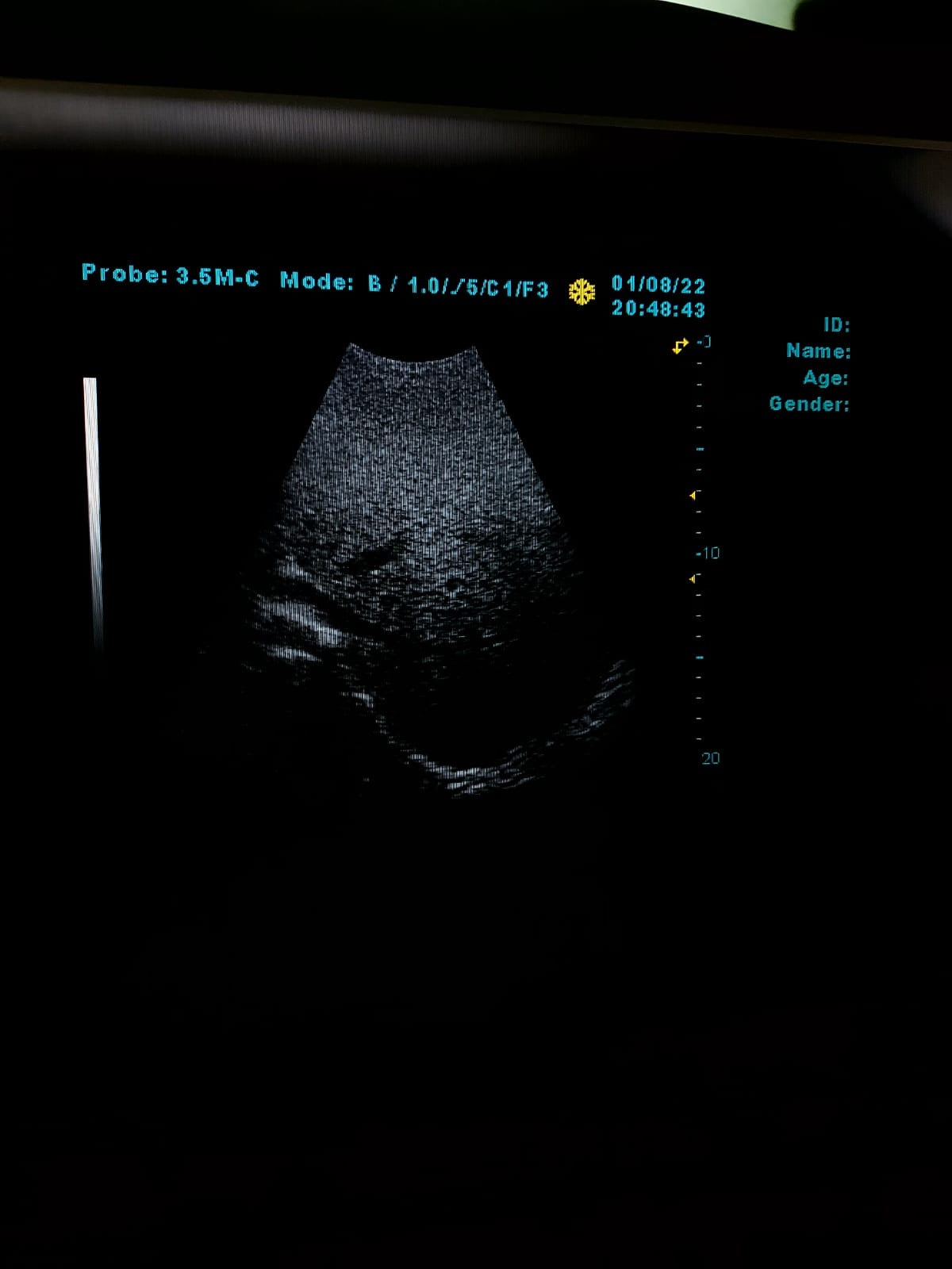 B..Linkton gray scale ultrasound machine, china used with convex probe