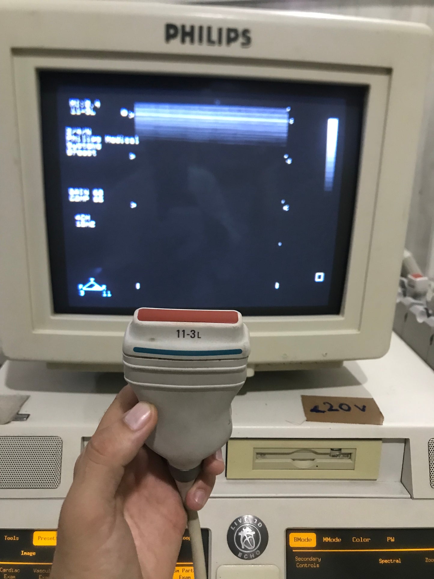 P...Philips 11-3L Linear Probe checked dxb