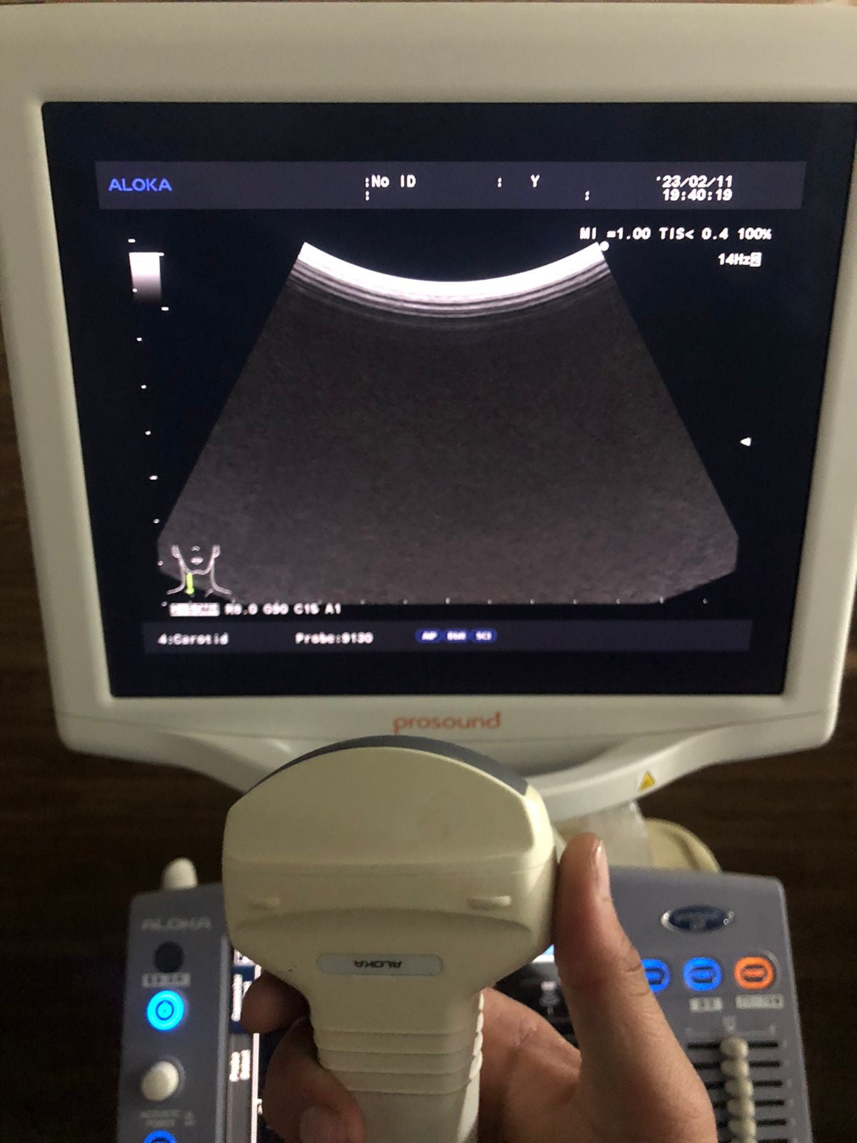 ..Aloka UST-9130 Convex Probe - Japan Medical Company LTD