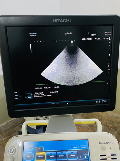 Hitachi Aloka ARIETTA 60 with convex linear cardiac probe, convex probe has air shade. Also can sell it's probes and parts separately