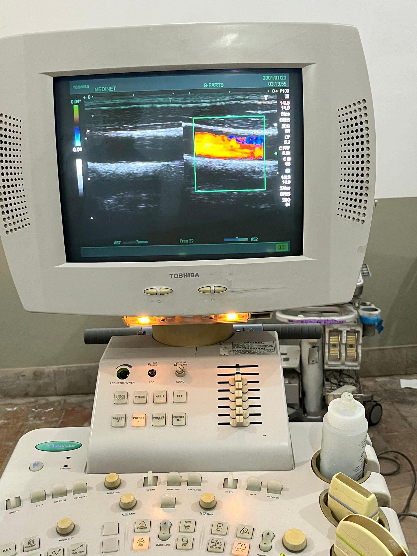 Toshiba Nemio 20 with convex linear probe