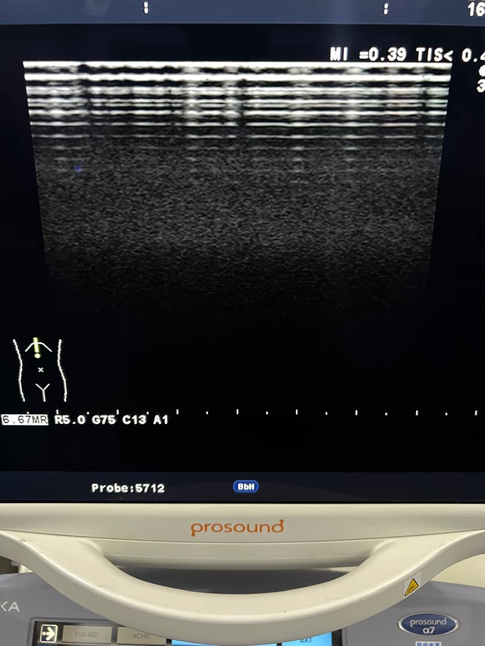 ..Hitachi UST-5712 linear vascular probe - Japan Medical Company LTD