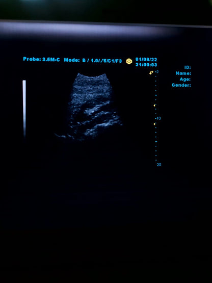 B..Linkton gray scale ultrasound machine, china used with convex probe