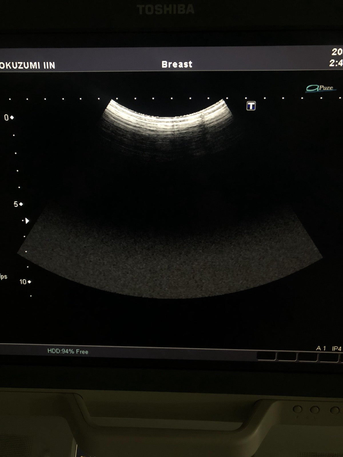 Toshiba PVT-375BT canvex probe - Japan Medical Company LTD