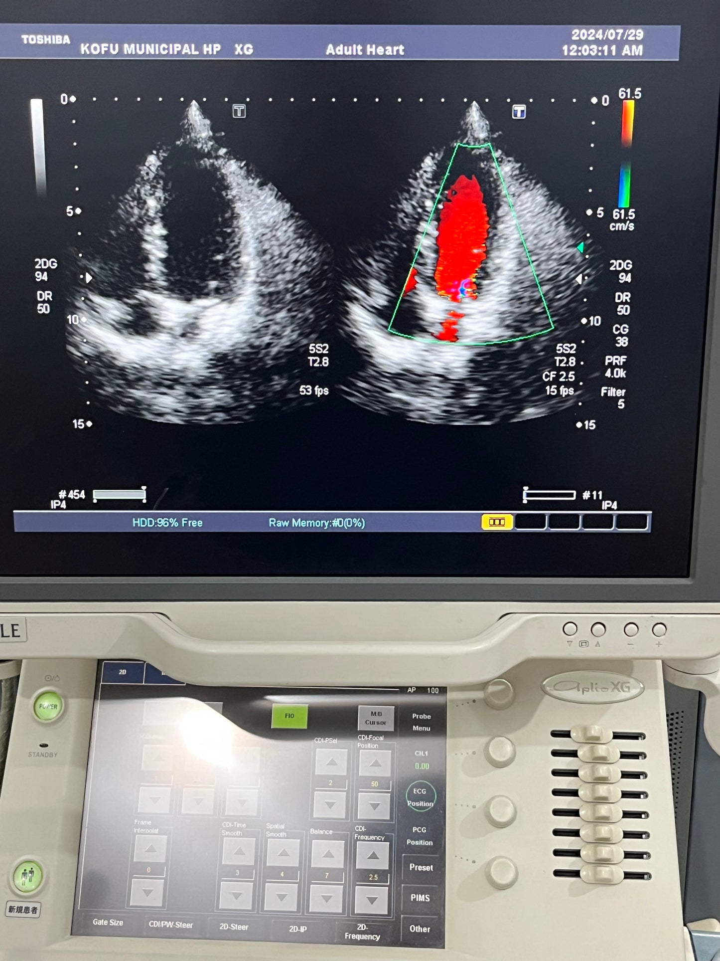 ..PST-30BT sector/Cardiac probe