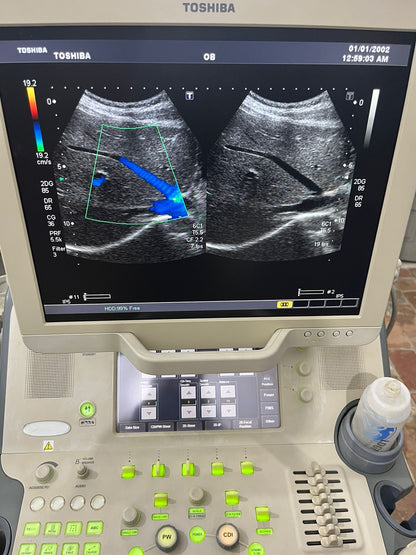 Toshiba Xario prime with convex linear probe