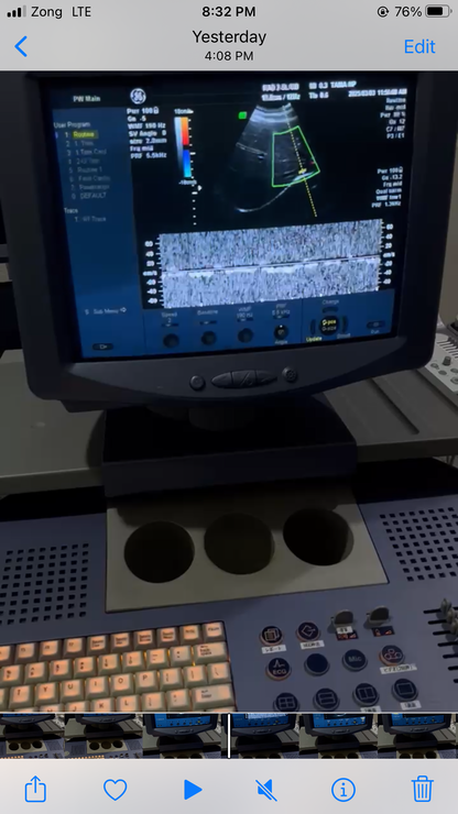 GE Voluson 730 pro v with convex probe